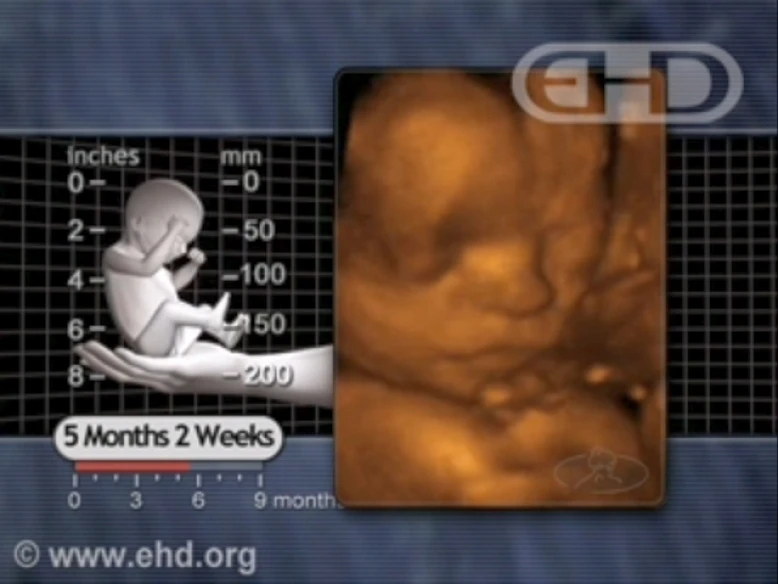 Un feto alla 24a settimana di gravidanza.